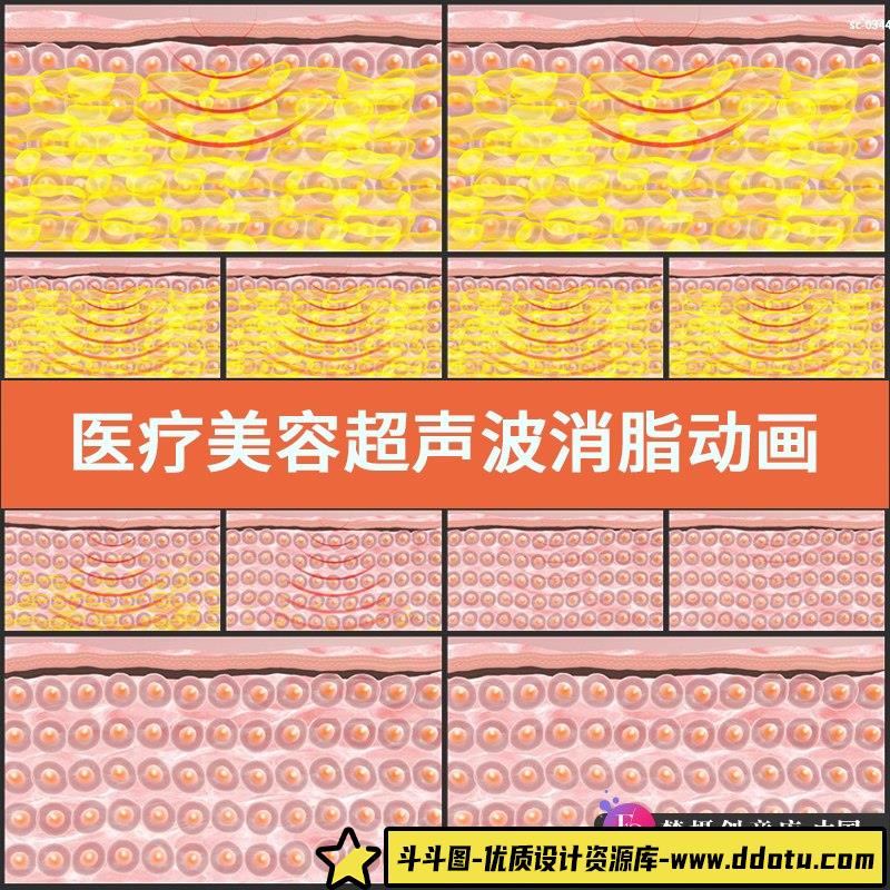 医疗美容超声波消脂动画视频素材热能量减脂减肥瘦身紧致脂肪消耗-斗斗图