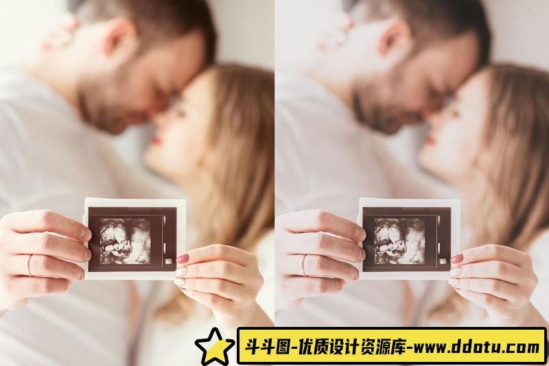 人像LR预设20个孕妈产妇肖像摄影后期预设lr预设ps滤镜pr调色lightroom人像lut插件